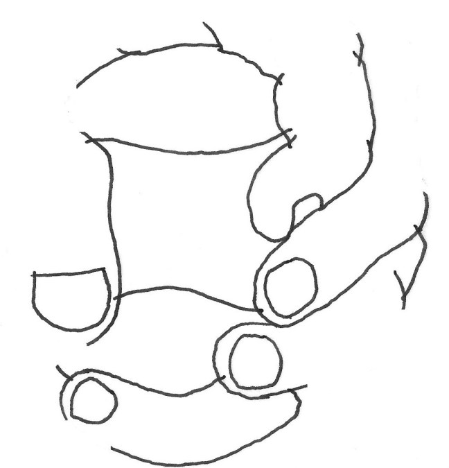 EUSKAL PILOTA BESOZ BESO DE MANO EN MANO arrebossart lateru82 lagunas tello, ruben